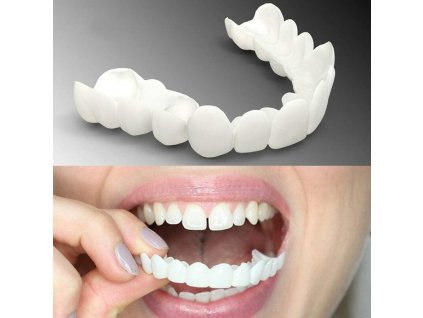 Proteze dentare temporare practice și detașabile